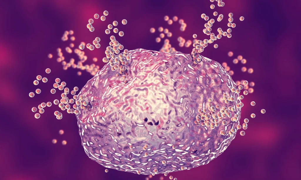 neuroinflammation and tics mast cell activation